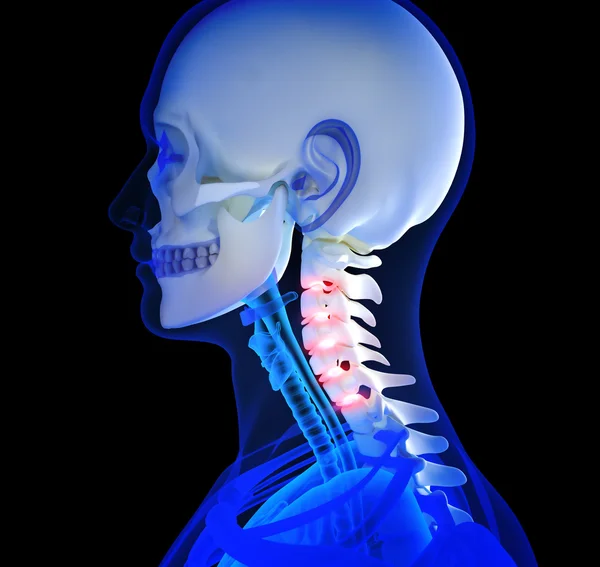 Dolor de cuello humano —  Fotos de Stock