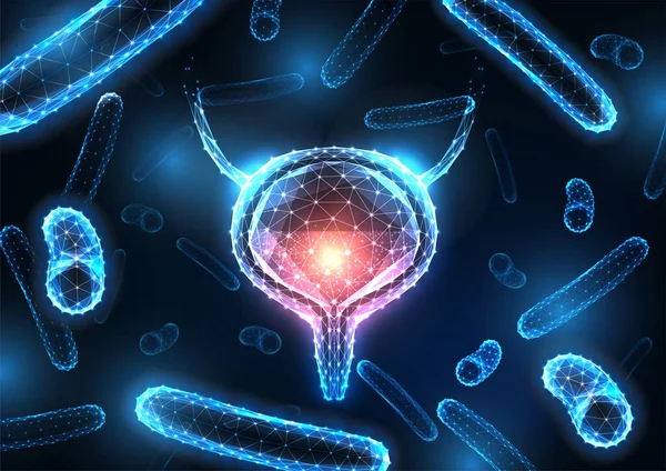 낭포성 방광 감염, 담청색에 빛나는 방광 과 박테리아가 있는 방광염 컨셉트 — 스톡 벡터
