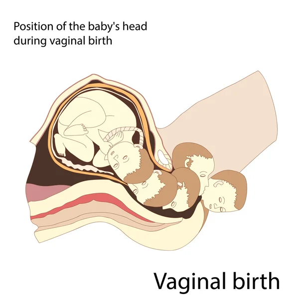 Parto vaginal — Vector de stock