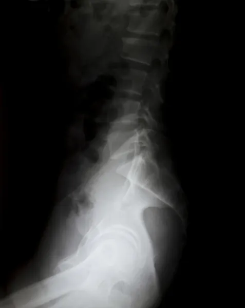Raggi X del bacino e della colonna vertebrale . — Foto Stock