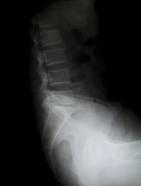 X-ray van het bekken en de wervelkolom. — Stockfoto