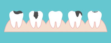 İnsan dişleri. Diş bakımı geçmişi. Vektör illüstrasyonu