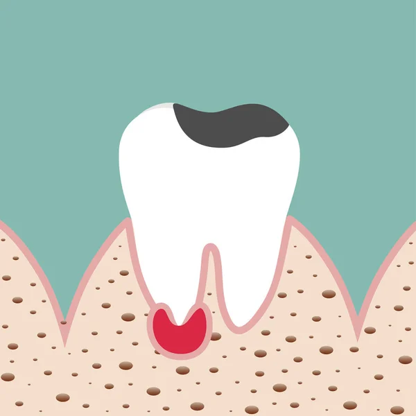 Denti Umani Esperienza Cura Dentale Illustrazione Vettoriale — Vettoriale Stock