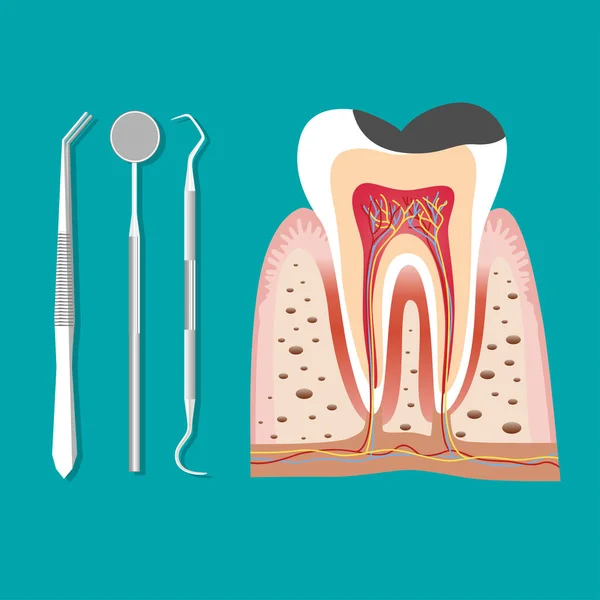 Zahnärztliche Instrumente Und Zahn Zahnärztliches Konzept Zur Zahnuntersuchung — Stockvektor