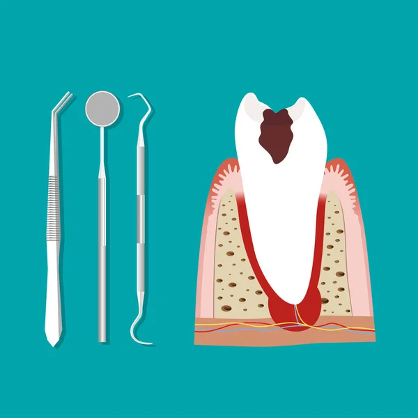 Instrumentos Dentários Dente Dentes Exame Odontológico Conceito — Vetor de Stock