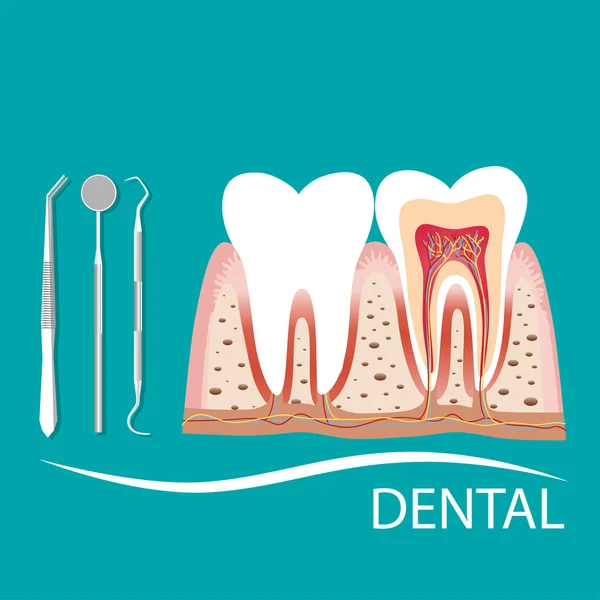 Strumenti Dentali Dente Denti Concetto Odontoiatria Esame — Vettoriale Stock