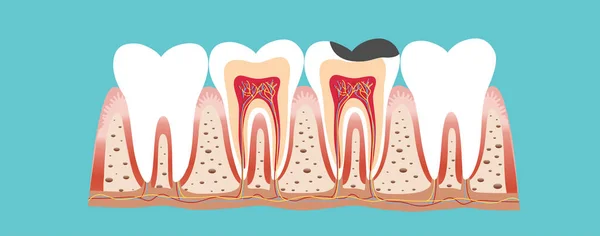 Человеческие Зубы Стоматологическое Образование Векторная Иллюстрация — стоковый вектор