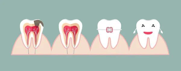 Dentes Humanos Antecedentes Cuidados Dentários Ilustração Vetorial Gráficos Vetores