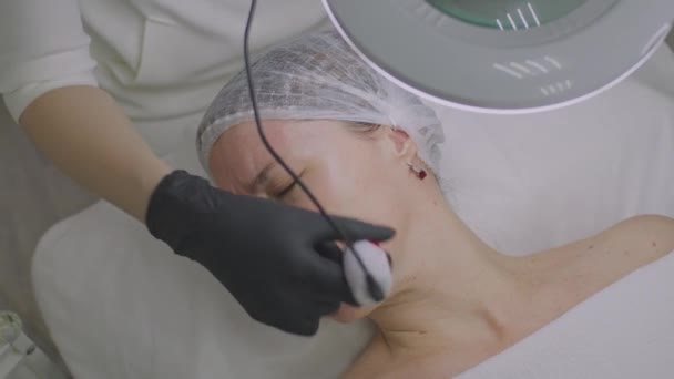 Primer plano de una cara de mujer. Procedimiento de mesoterapia con aguja en la piel de la cara — Vídeos de Stock
