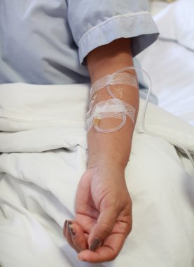 IV damla kadın hastanın elinde yakın çekim