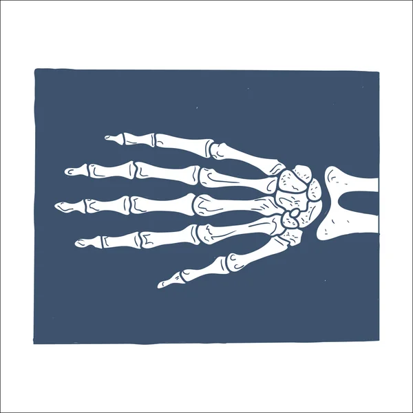 Hand X-ray picture. — Stock Vector
