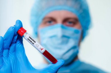 Tıbbi laboratuvar asistanı pozitif Coronavirus kan örneğiyle test tüpü tutuyor..