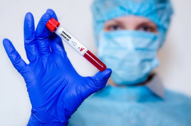Tıbbi laboratuvar asistanı pozitif Coronavirus kan örneğiyle test tüpü tutuyor..