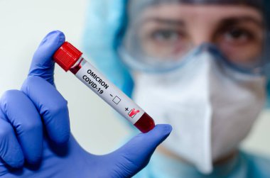 Tıbbi laboratuvar asistanı Omicron COVID-19 kan örneğiyle test tüpü tutuyor..