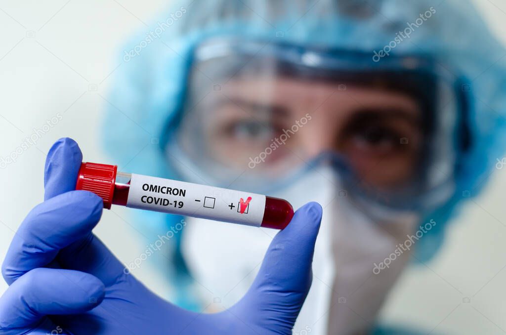 Medical laboratory assistant holding test tube with positive Omicron COVID-19 test blood sample.
