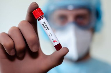 Medical laboratory assistant holding test tube with positive Deltacron COVID-19 test blood sample.
