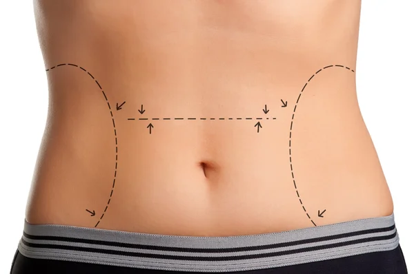 Cirurgia Plástica — Fotografia de Stock