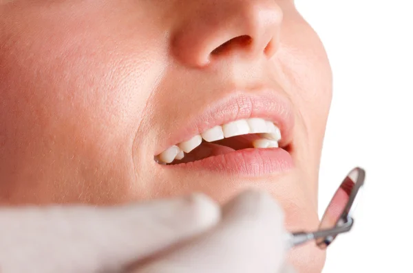 Close-up de um dentista no trabalho — Fotografia de Stock