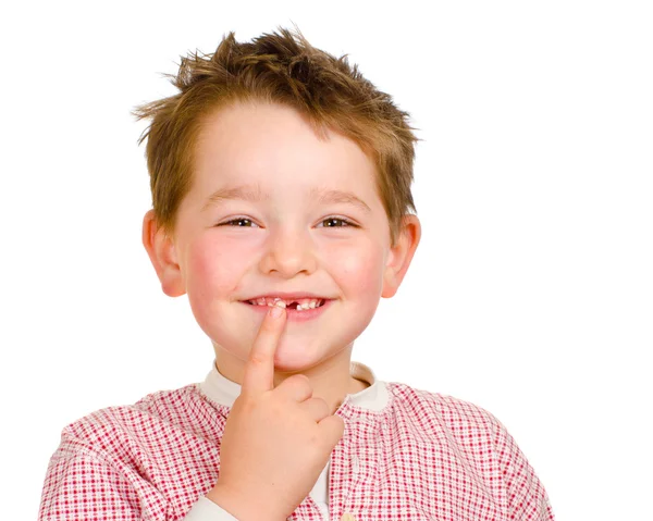 Criança mostrando seus dentes perdidos isolados em branco — Fotografia de Stock