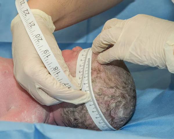 Niño lactante que se mide la cabeza después del parto en el hospital — Foto de Stock