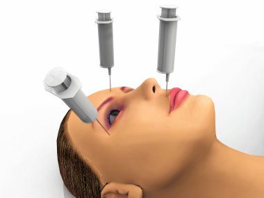kadın ve birçok botox şırınga