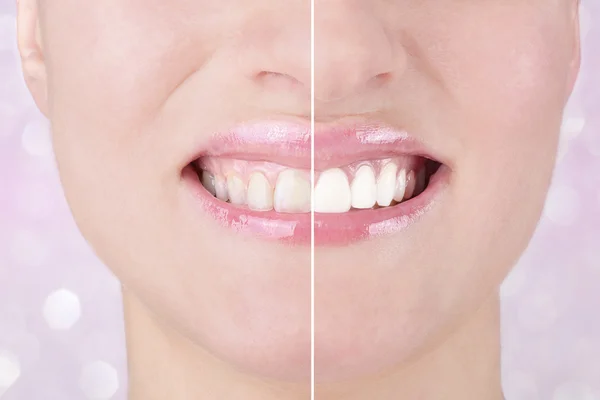 Woman teeth — Stock Photo, Image