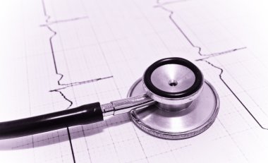 Kardiyogramda steteskop