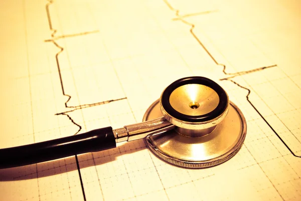 Kardiyogramda steteskop