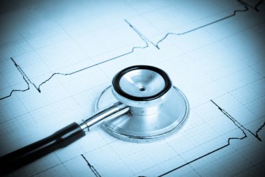 Kardiyogramda steteskop