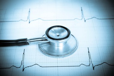 Kardiyogramda steteskop