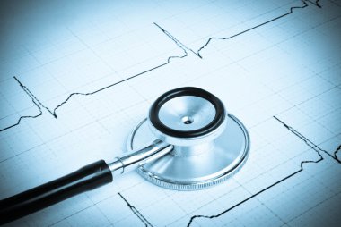 Kardiyogramda steteskop