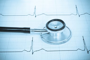 Kardiyogramda steteskop