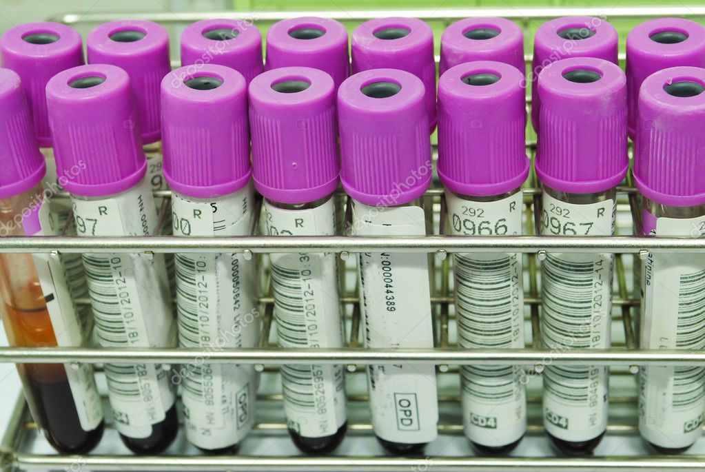 A view blood tubes in detail — Stock Photo © niamwhan 30088277