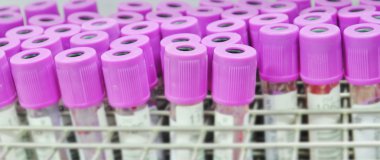 ayrıntılı bir görünüm kan tüpleri