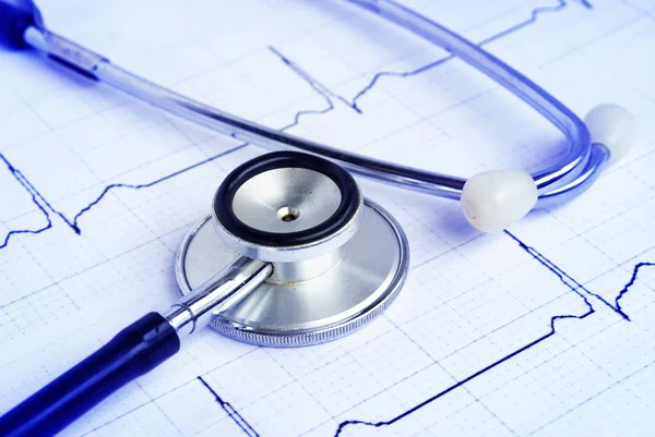 Stethoscoop op een cardiogram — Stockfoto