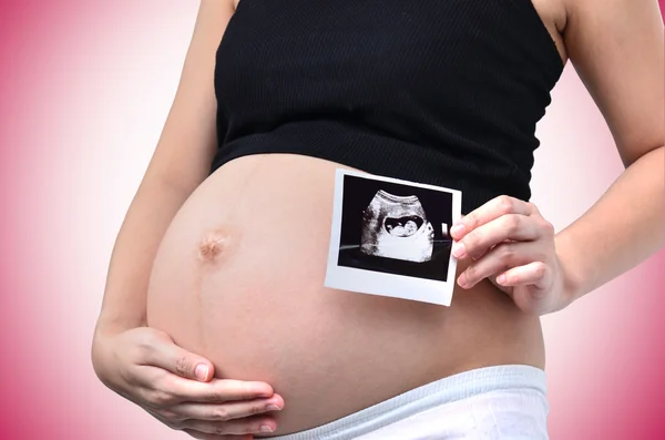 Pregnant woman — Stock Photo, Image