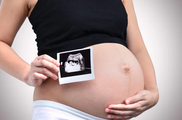 Gravid kvinna — Stockfoto