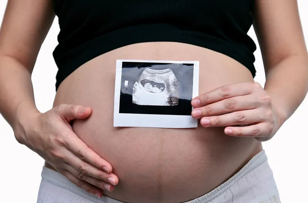 Signora incinta. — Foto Stock