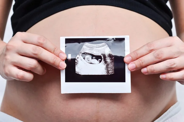 Pregnant women — Stock Photo, Image