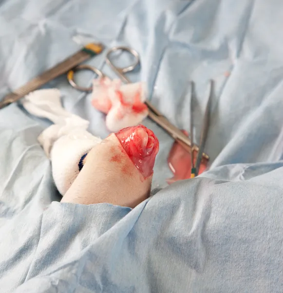 Rodilla de perro pequeño durante la operación — Foto de Stock