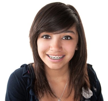 diş teli ile gülümseyen sevimli Latin kız