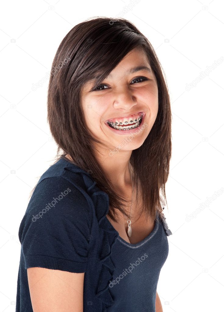 Cute Girl Braces For Teeth Cute Girl Braces For Teeth