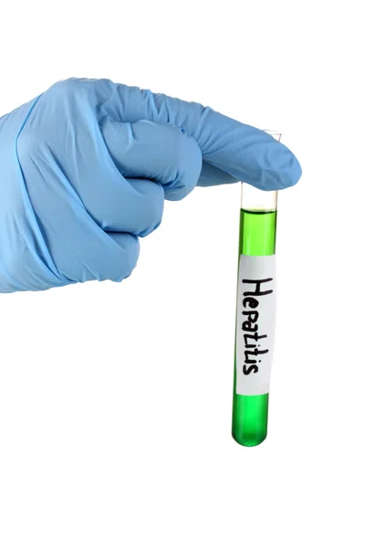 Reagenzglas mit Hepatitis isoliert auf weiß — Stockfoto