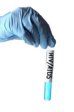 tüp bebek beyaz izole hivaids etiketli