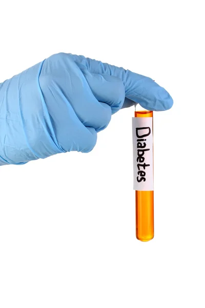 Tubo di prova etichettato Diabete isolato su bianco — Foto Stock