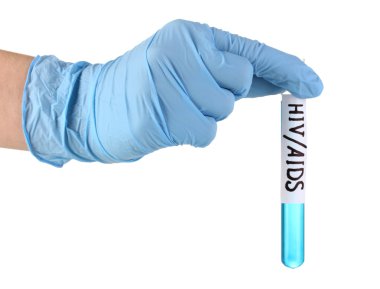 tüp bebek beyaz izole hivaids etiketli