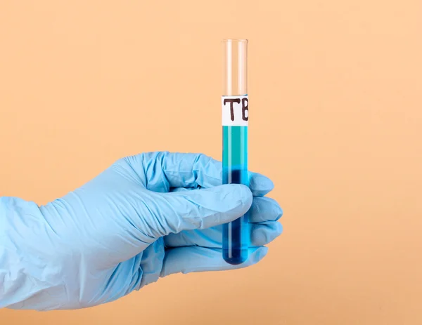 Test tube labeled Tuberculosis(TB) in hand on beige background — Stock Photo, Image