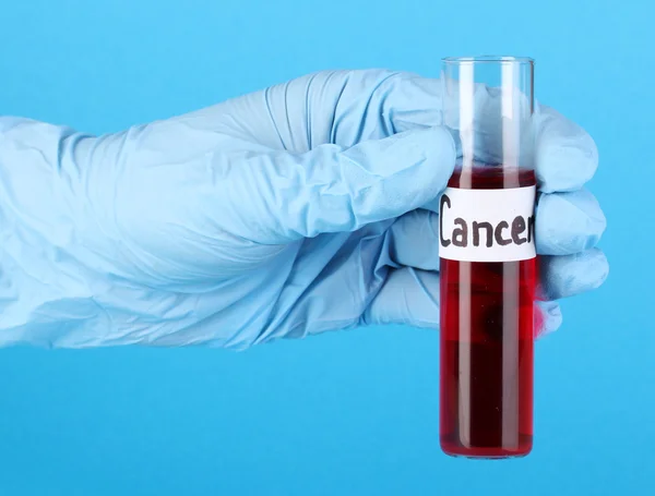 Test tube labeled Cancer in hand on blue background — Stock Photo, Image