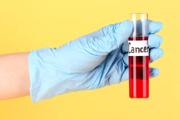 Test tube labeled Cancer in hand on yellow background — Stok fotoğraf