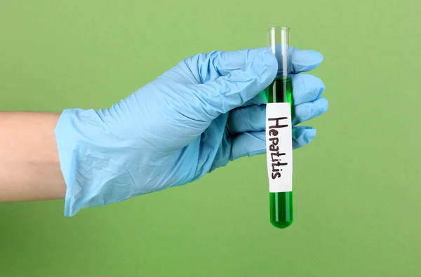 Tubo de ensayo etiquetado Hepatitis en la mano sobre fondo verde —  Fotos de Stock